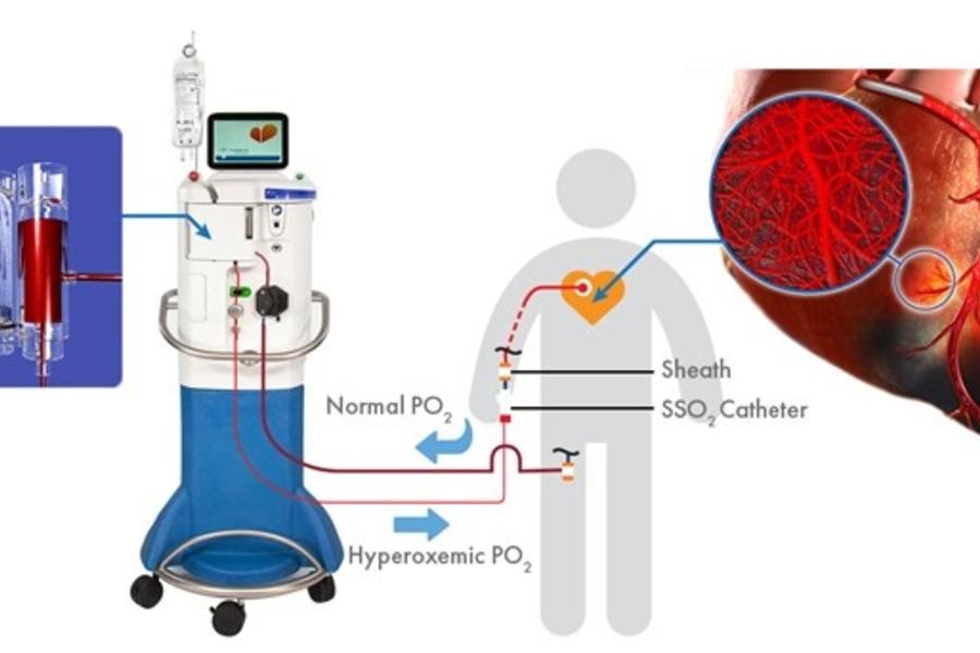 Cardiologists at CAMC among first in state to offer new therapy to